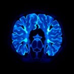 enhancing-low-dose-ct-scans-with-interpretable-multi-gaussian-cluster-variance-reduction