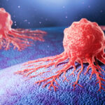 enzymes-involved-in-cholesterol-transport-may-point-to-new-cancer-therapies
