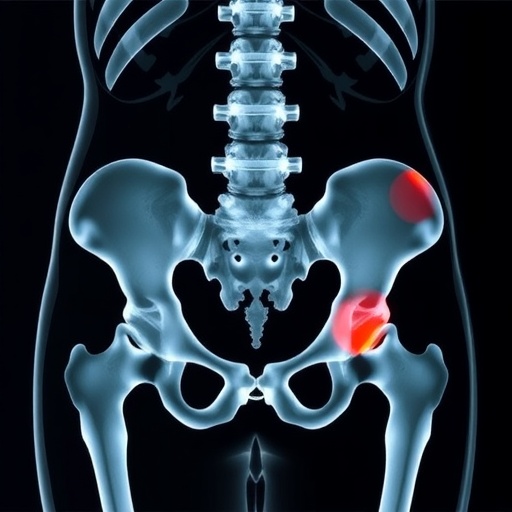 assessing-osteoporotic-pelvis-fracture-score-feasibility