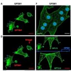 gpsm1-limits-cd73+cd103+-tregs-driving-obesity-damage