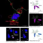 hdac4-protac-boosts-lung-cancer-ferroptosis,-sensitizes-radiation