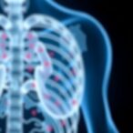 how-ceramide-lipid-metabolism-influences-prostate-cancer-drug-response