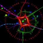 nuclear-oxct1-suppresses-mhc-i-via-histone-modification