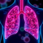lung-cancer-cells-change-identity-to-evade-treatment-resistance