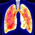 expert-diffusion-model-predicts,-localizes-lung-cancer-stas