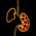 toxicology-links-cadmium-exposure-to-pancreatic-cancer