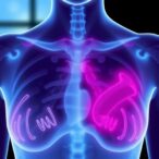 gene-testing-safely-spares-many-breast-cancer-patients-from-chemotherapy