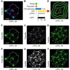 lrp2-controls-ferroptosis-via-wnt/gpx4-in-crc