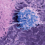 target-for-aggressive-prostate-cancer-prevention-identified-in-mice