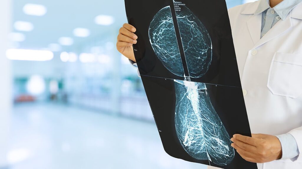 asco,-ryght-ai-team-up-for-breast-cancer-trial-site-selection