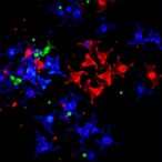 c/ebpγ-drives-emt-and-dna-repair-in-lung-cancer