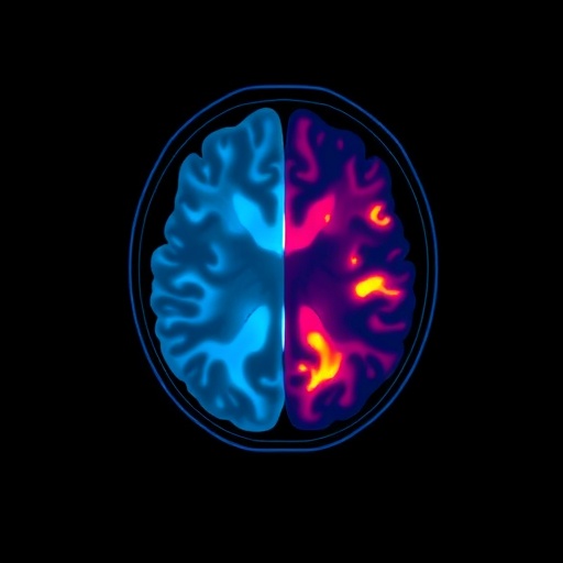 mri-endpoints-redefined-for-ataxia-clinical-trials