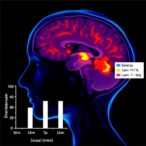 diazepam-response-in-pediatric-status-epilepticus-study
