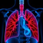hyperoxia,-lung-injury,-and-new-bronchopulmonary-dysplasia-treatments