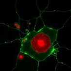 tuberculosis-exploits-idh-pparγ-to-trigger-macrophage-ferroptosis
