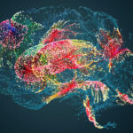 brain-aneurysm-study-identifies-structural,-immune-markers-of-rupture-risk