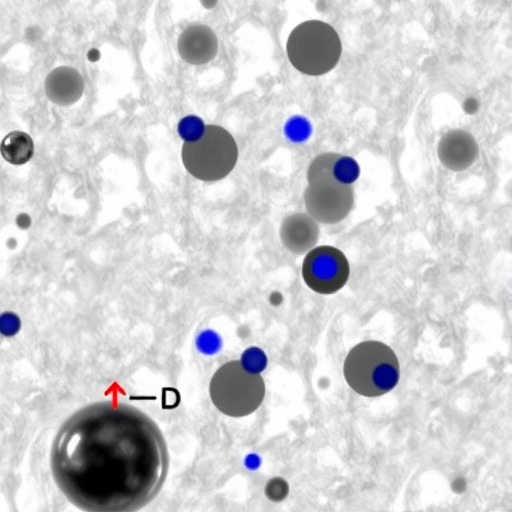 oligoclonal-expansion-of-atypical-vδ2−-γδ-t-cells-in-good’s-syndrome