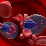 predicta-links-with-spanish-university-to-offer-diagnostic-for-blood-cancers