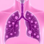 anti-cd4-therapy-boosts-cd8+-immunity,-halts-lung-cancer