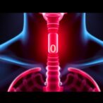 mit-engineers-develop-targeted-drug-delivery-system-for-the-esophagus