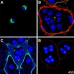 plk4-inhibitor-rp-1664-shows-dual-action-in-neuroblastoma