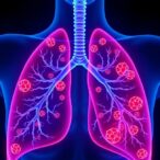 gpr84-drives-lung-inflammation-via-zbp1-panoptosome-activation