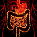 unraveling-pet-mps’-role-in-inflammatory-bowel-disease