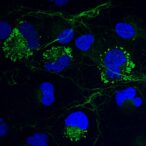 collagen-resides-inside-cells-in-liquid-condensate-like-form