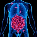 adiposity-and-cancer:-exploring-links-and-future-insights