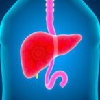 steatotic-liver-disease-in-latin-america:-insights