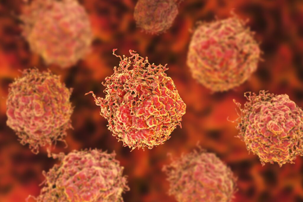 silica-nanoparticles-induce-ferroptosis,-reprogram-immunity-in-prostate-cancer-models