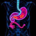 new-tomography-based-marker-advances-accuracy-of-gastric-cancer-prognosis