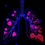 ikkα-controlled-mir-9-5p-drives-lung-cancer-progression
