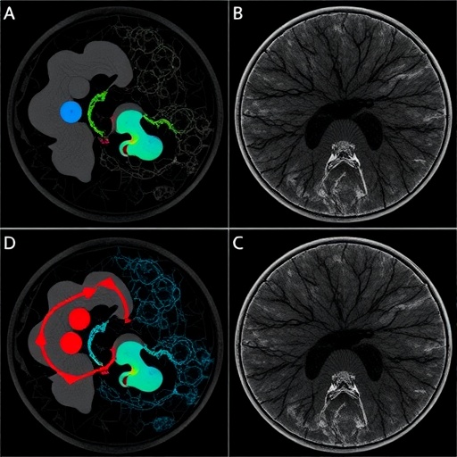 tracing-metastasis-and-evolution-in-uveal-melanoma
