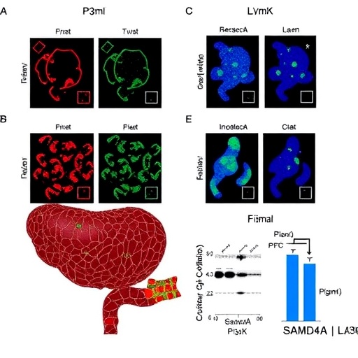 lamb3-boosts-gastric-cancer-via-samd4a-and-pi3k