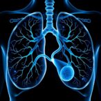 multimodal-multitask-ai-transforms-lung-cancer-grading