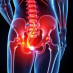 unilateral-epidural-anesthesia-benefits-older-hip-fracture-patients
