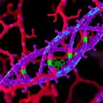 aoc1-controls-labor-via-spermidine-driven-autophagy