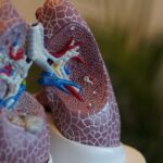 three-subtypes-of-severe-pneumonia-might-inform-personalized-therapies