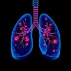 building-trust-with-uncertainty-aware-ai-in-lung-cancer