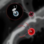 micro/nanorobotic-systems-enable-imaging-guided-closed-loop-thrombus-recanalization