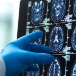abbott-pens-blood-based-alzheimer’s-testing-pact-with-alzpath