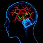 antler-stem-cells-relieve-cerebral-ischemic-injury