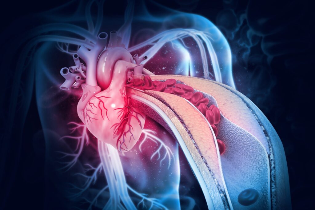drug-targets-ldl-receptor-pathway-to-control-cholesterol
