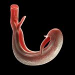 schistosomiasis-vaccine-shows-strong-immune-memory-in-early-clinical-trials