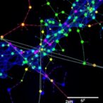 tubulin-cofactor-b-drives-glioblastoma-cell-migration