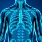 ibuprofen-as-adjunct-in-drug-resistant-tuberculosis-trial