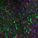 in-huntington’s-mouse,-optogenetic-activation-of-vip-neurons-restores-brain-function