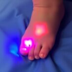 laser-lancing-non-inferior-to-heel-prick-for-preemies