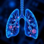 multi-metal-cooperation-drives-lung-cancer-chemoresistance,-reversed-by-miadmsa